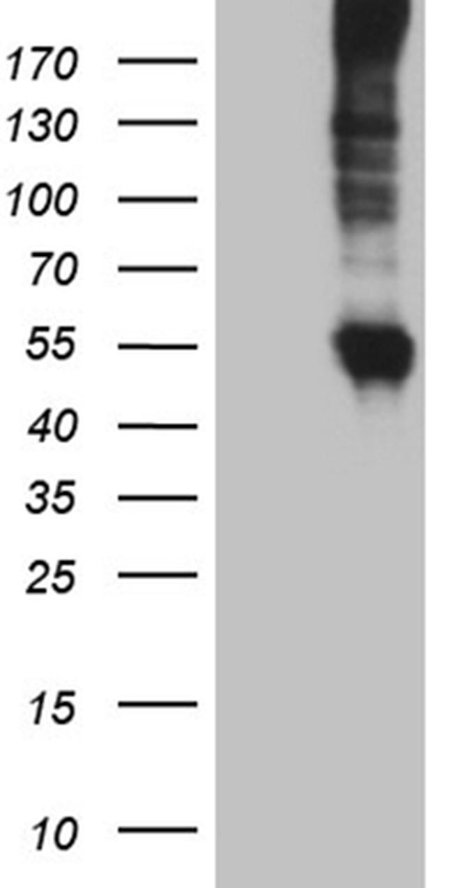 SLC22A17 Antibody in Western Blot (WB)