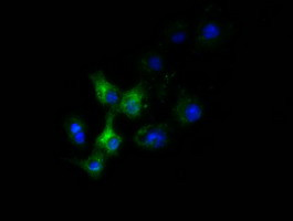 SLC30A3 Antibody in Immunocytochemistry (ICC/IF)