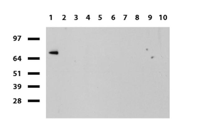 SLC7A8 Antibody in Western Blot (WB)