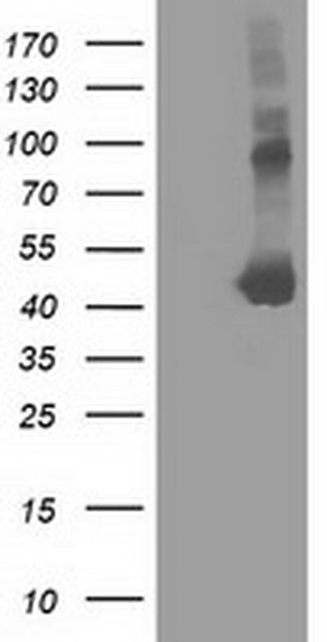 SLFNL1 Antibody in Western Blot (WB)