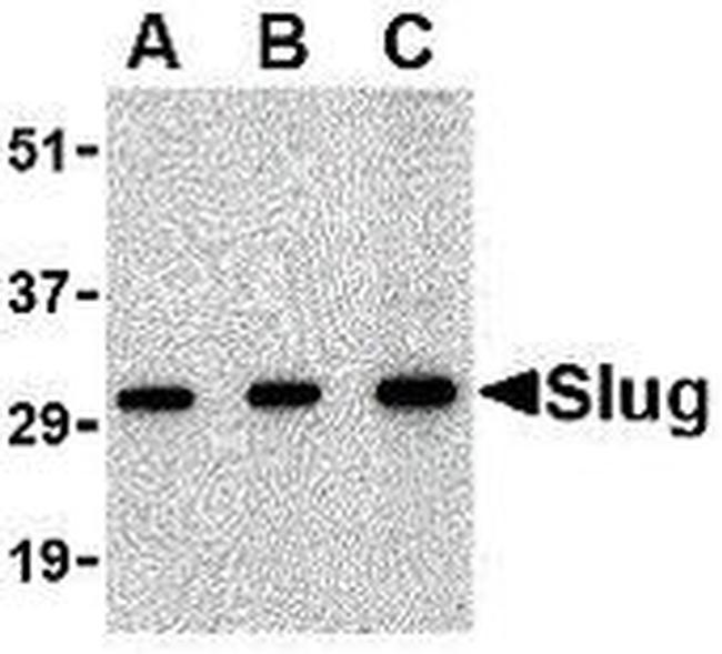 SLUG Antibody in Western Blot (WB)