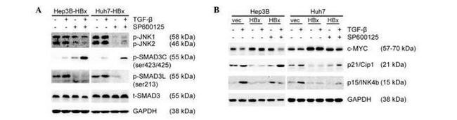 Phospho-SMAD3 (Ser213) Antibody in Western Blot (WB)