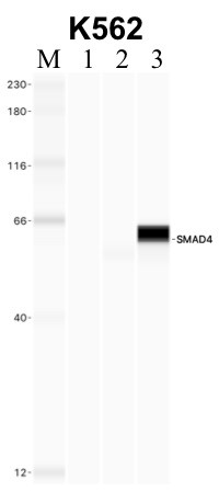 SMAD4 Antibody in Immunoprecipitation (IP)