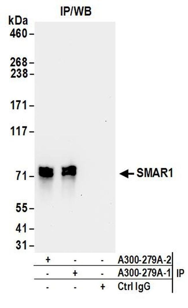 SMAR1/BANP Antibody in Western Blot (WB)