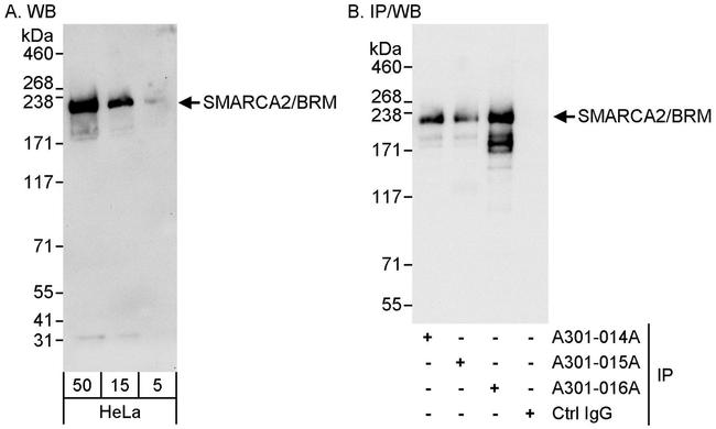SMARCA2/BRM Antibody in Western Blot (WB)