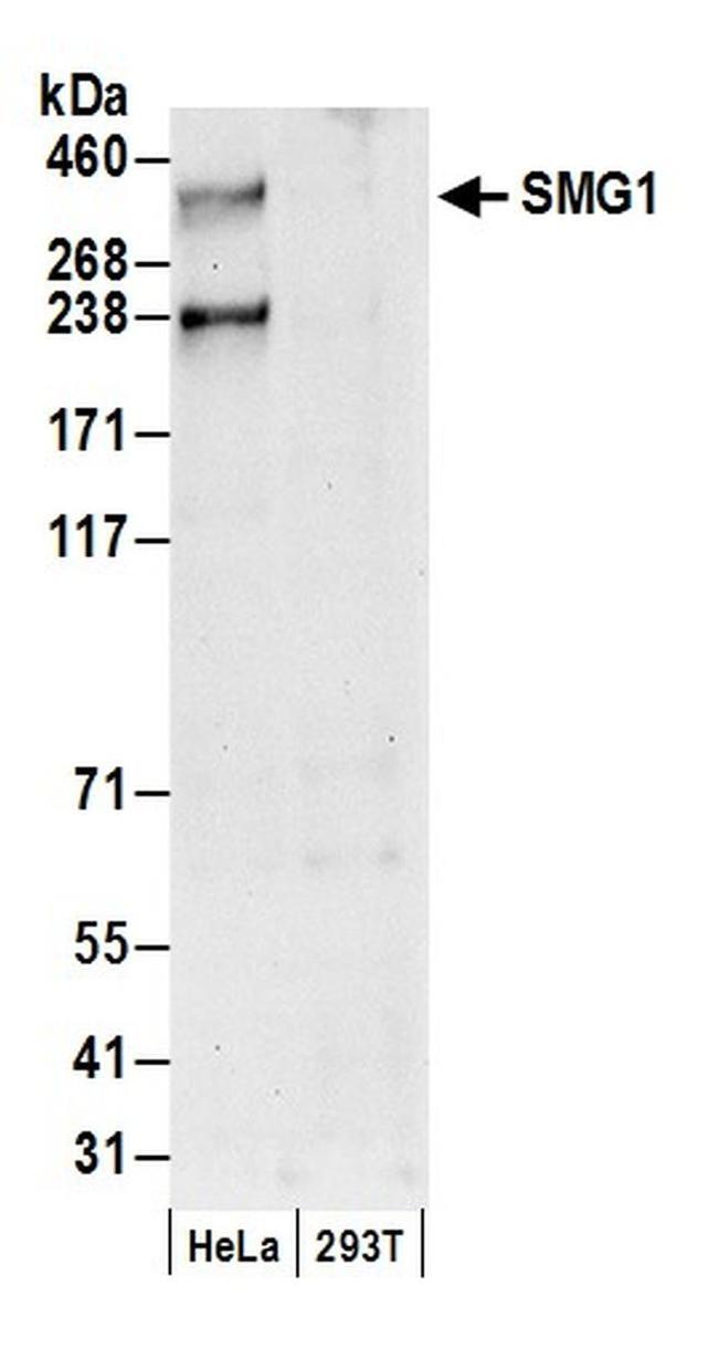 SMG1 Antibody in Western Blot (WB)