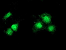 SNTA1 Antibody in Immunocytochemistry (ICC/IF)