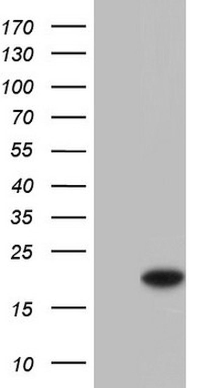 SNX12 Antibody in Western Blot (WB)