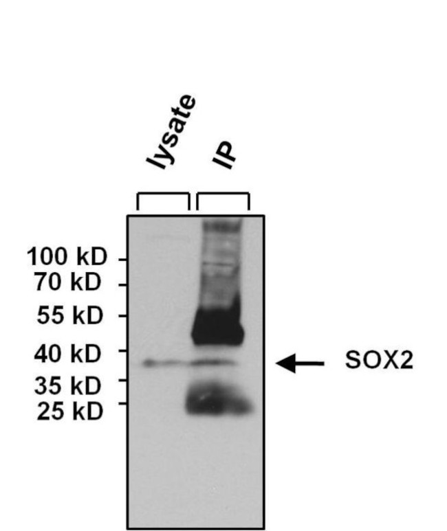 SOX2 Antibody in Immunoprecipitation (IP)