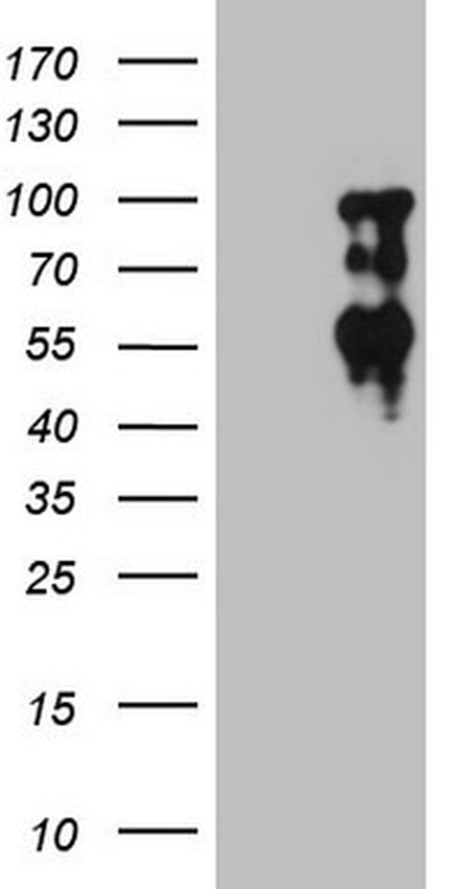 SOX6 Antibody in Western Blot (WB)