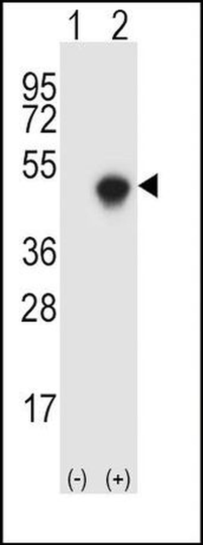 SPHK1 Antibody in Western Blot (WB)