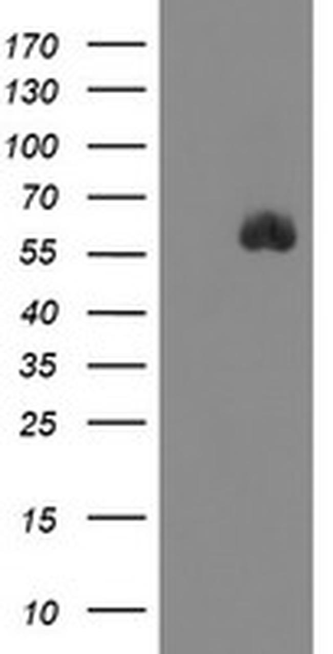 SPINT1 Antibody in Western Blot (WB)