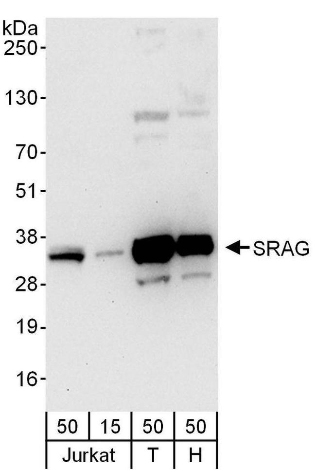 SRAG Antibody in Western Blot (WB)