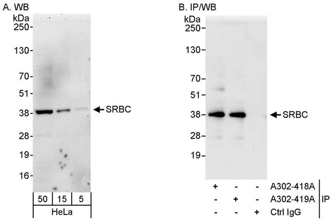 SRBC Antibody in Western Blot (WB)