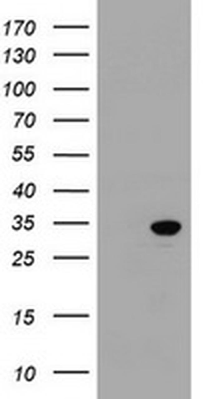 SRPRB Antibody in Western Blot (WB)