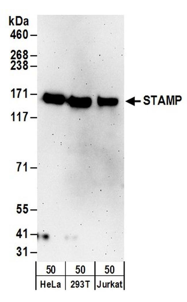 STAMP Antibody in Western Blot (WB)