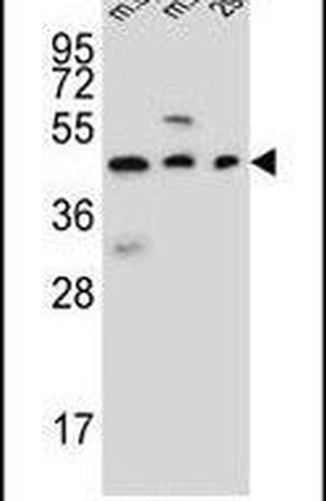 STEAP2 Antibody in Western Blot (WB)