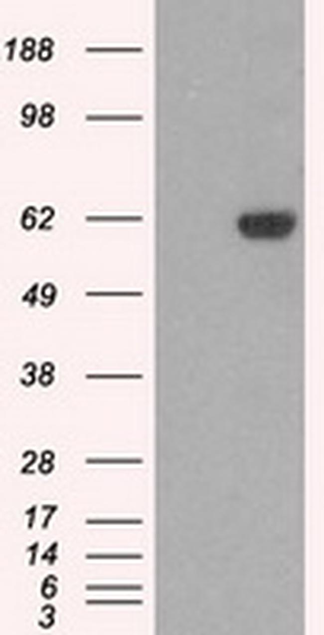 STK39 Antibody in Western Blot (WB)