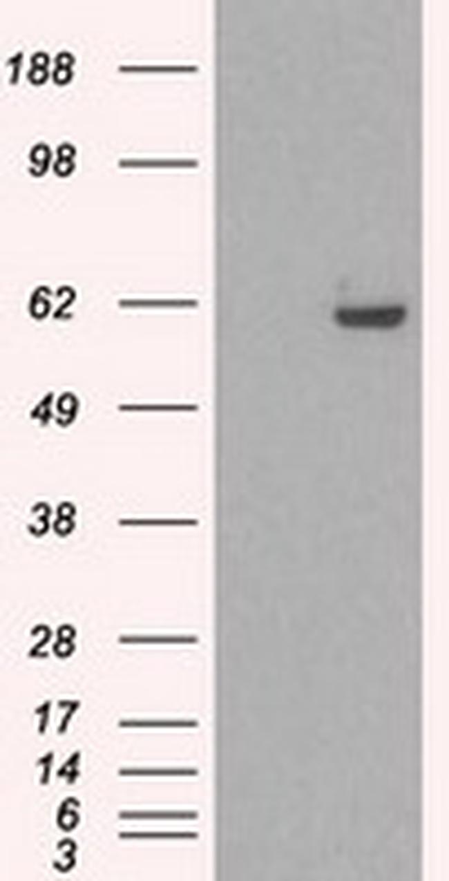 STK39 Antibody in Western Blot (WB)