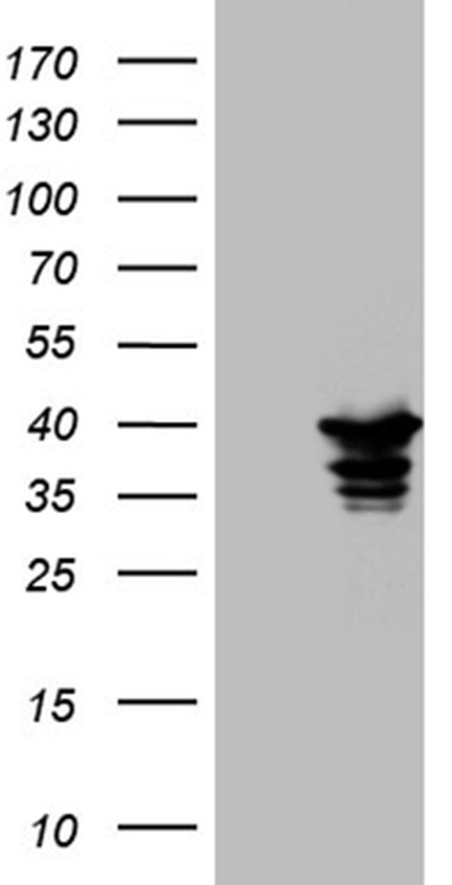 SUGT1 Antibody in Western Blot (WB)
