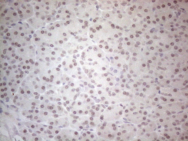 SUPT3H Antibody in Immunohistochemistry (Paraffin) (IHC (P))
