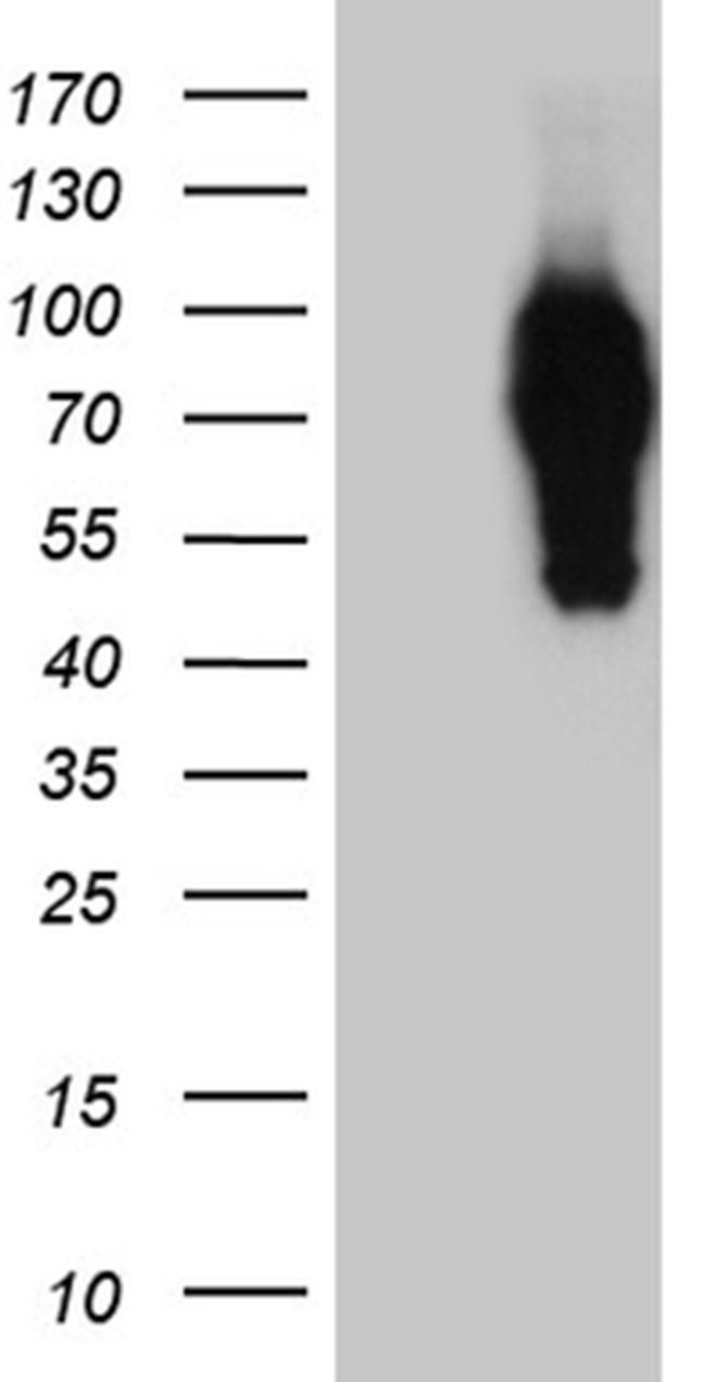 SYTL4 Antibody in Western Blot (WB)