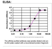 Aldolase B Antibody in ELISA (ELISA)