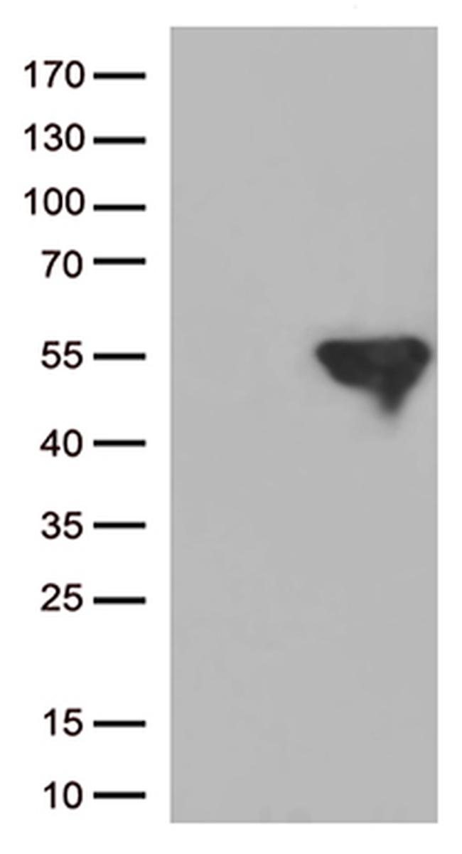 IKK gamma (IKBKG) Antibody in Western Blot (WB)