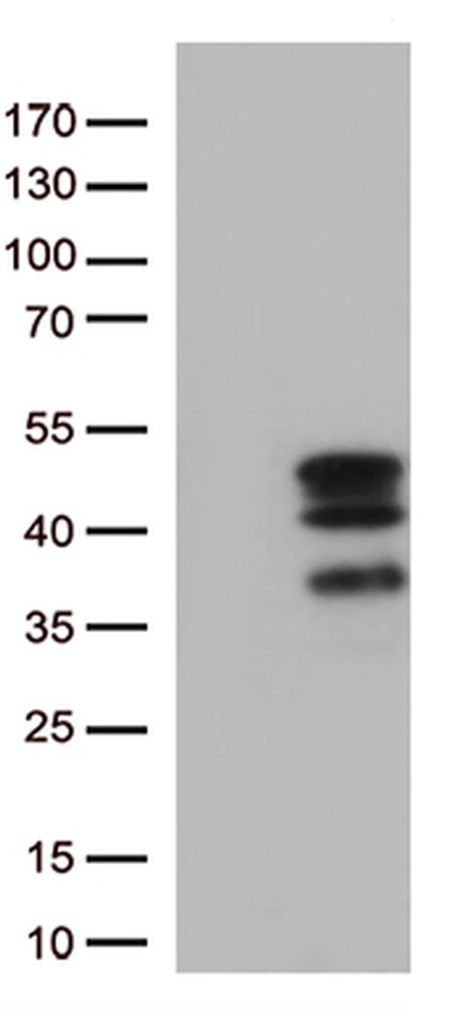 VGLL3 Antibody in Western Blot (WB)