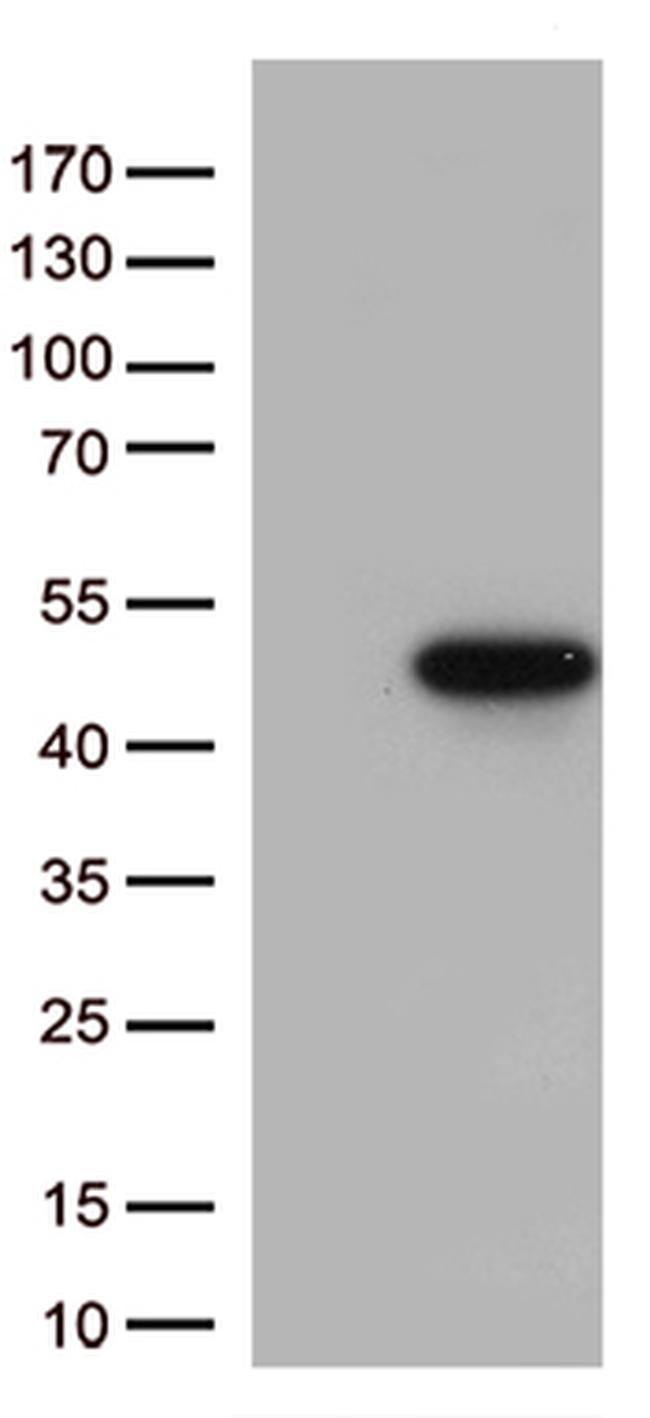 p38 (MAPK14) Antibody in Western Blot (WB)