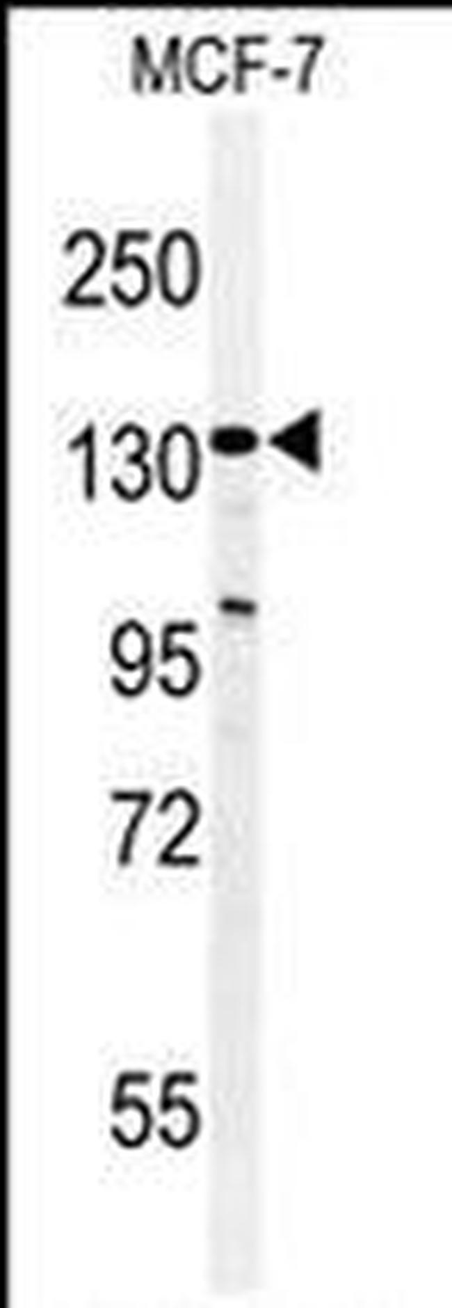 TAF2 Antibody in Western Blot (WB)