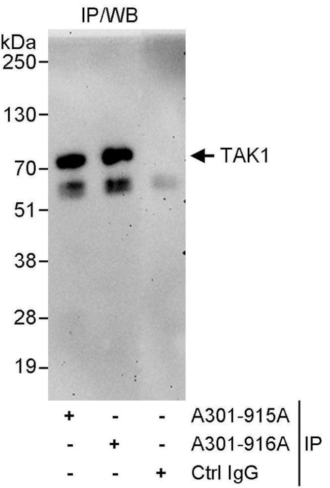 TAK1 Antibody in Immunoprecipitation (IP)