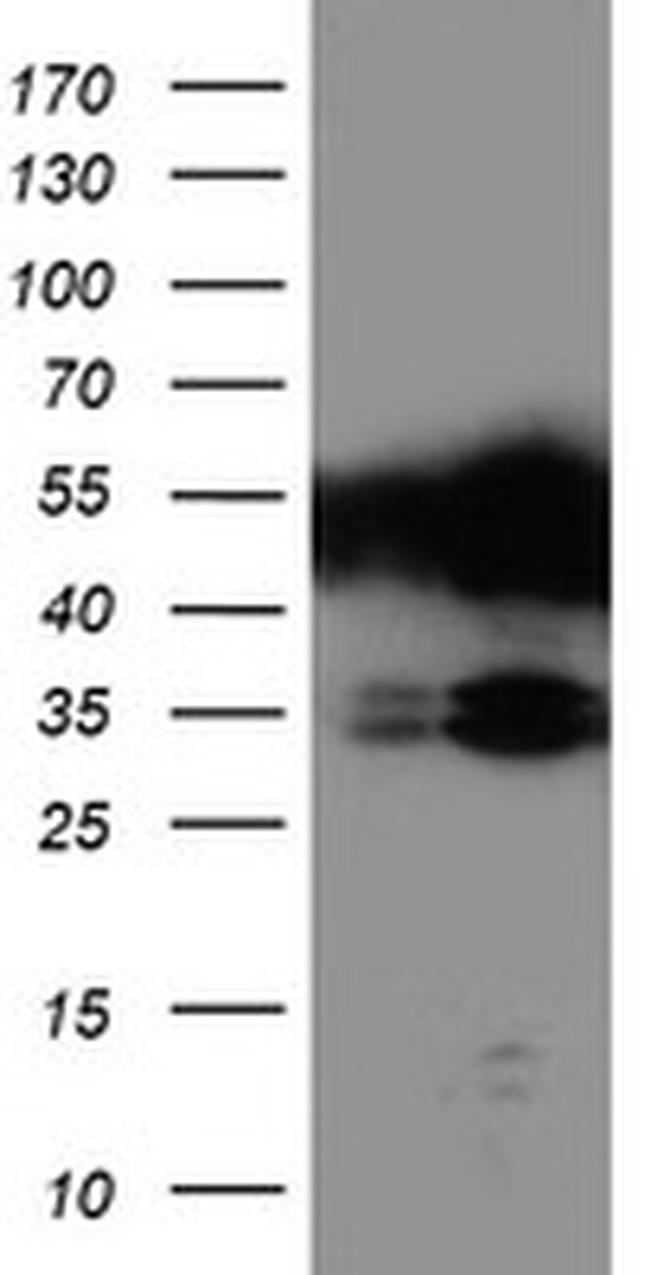 TAL1 Antibody in Western Blot (WB)