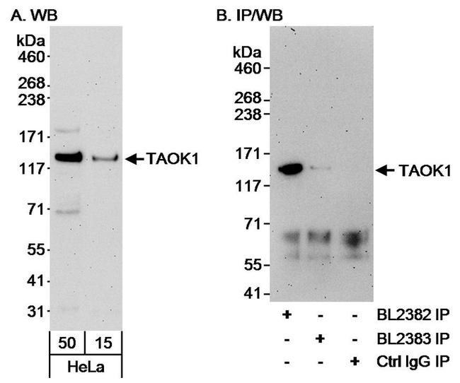 TAOK1 Antibody in Western Blot (WB)