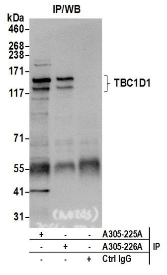TBC1D1 Antibody in Immunoprecipitation (IP)