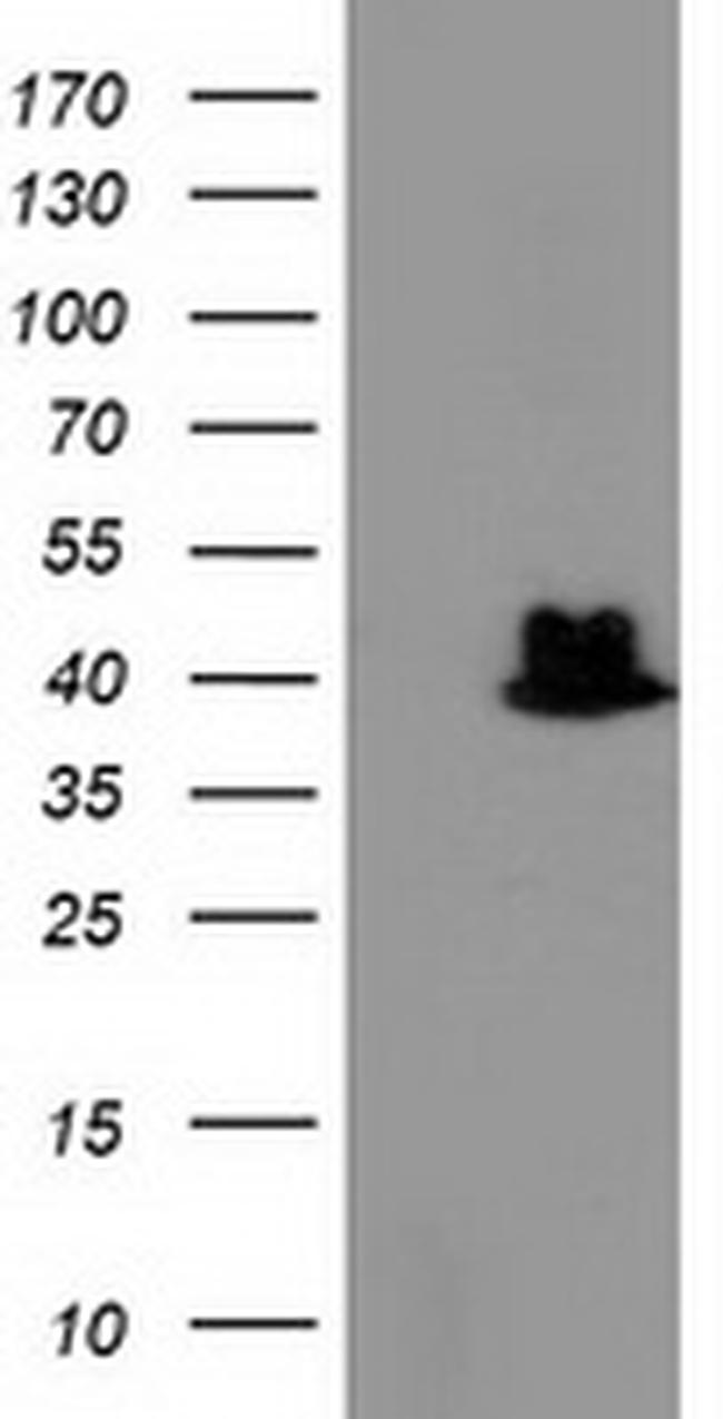 TBC1D21 Antibody in Western Blot (WB)