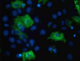 TBC1D4 Antibody in Immunocytochemistry (ICC/IF)