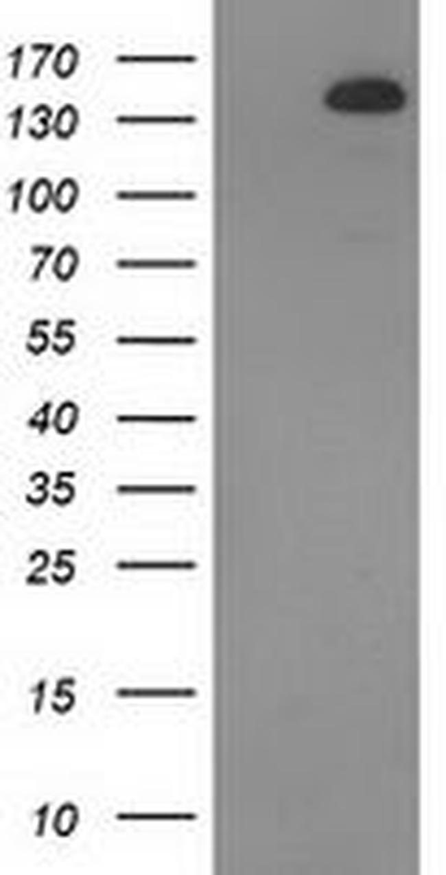 TBC1D4 Antibody in Western Blot (WB)