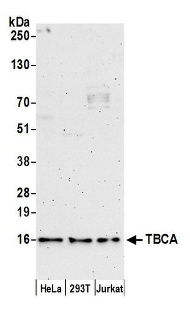TBCA Antibody in Western Blot (WB)