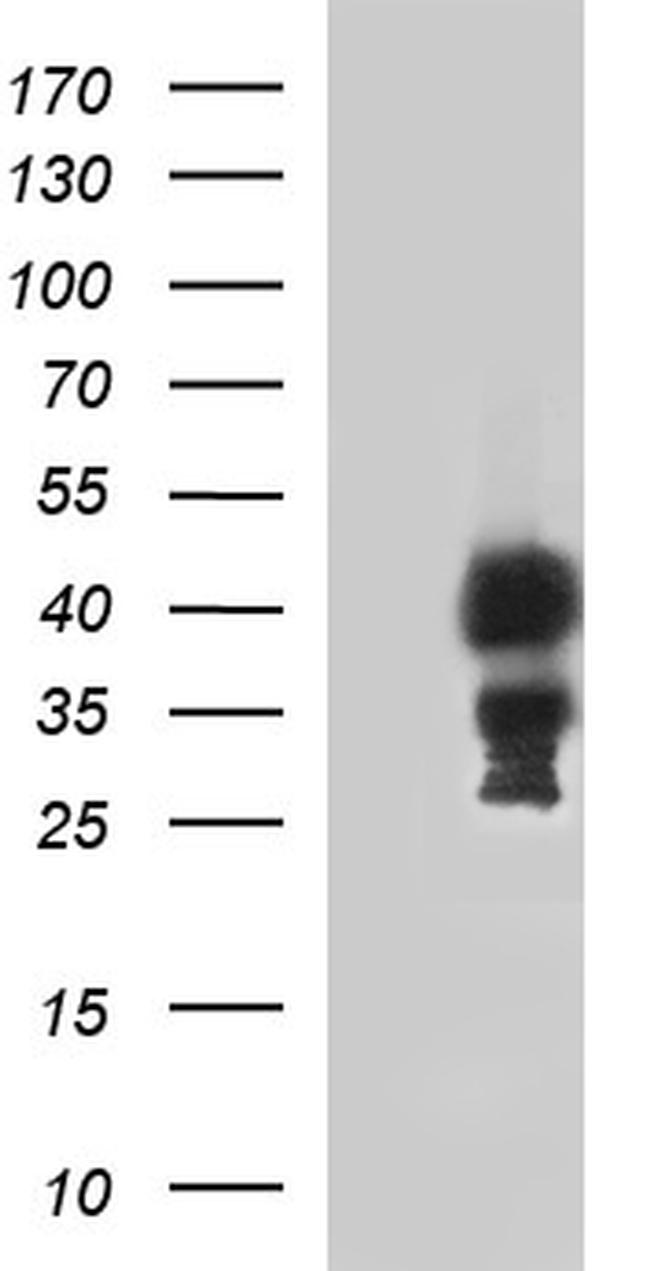TBX1 Antibody in Western Blot (WB)