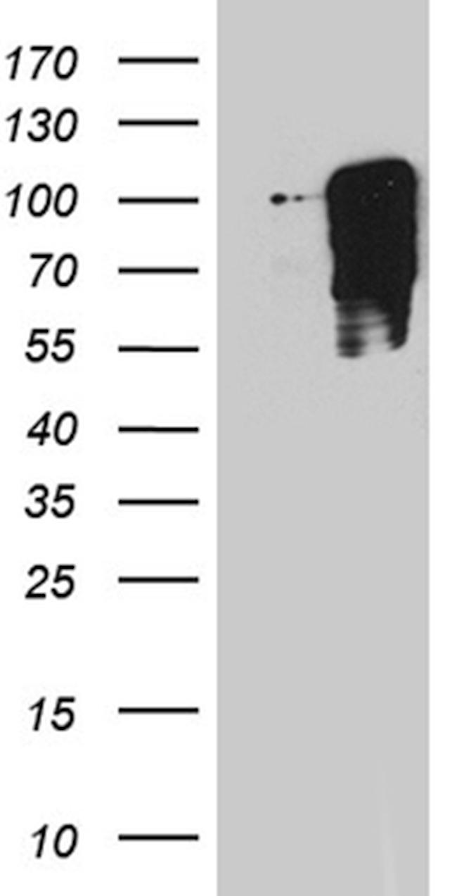 TBX3 Antibody in Western Blot (WB)