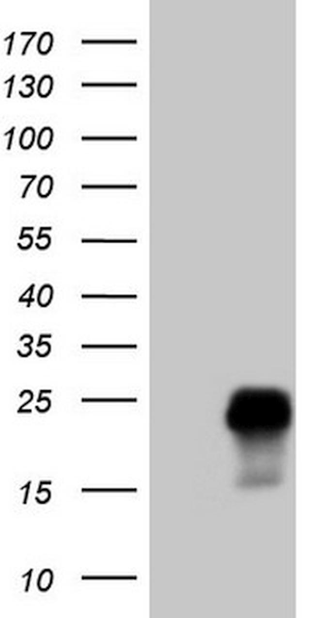 TCAP Antibody in Western Blot (WB)
