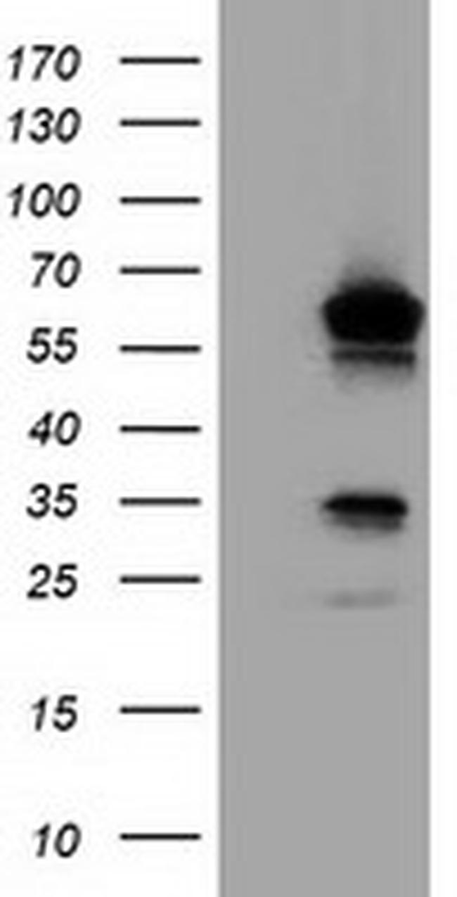 TCP11L2 Antibody in Western Blot (WB)
