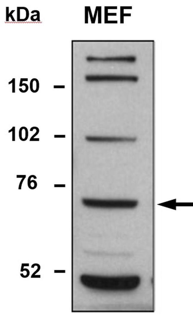 TDP1 Antibody in Western Blot (WB)