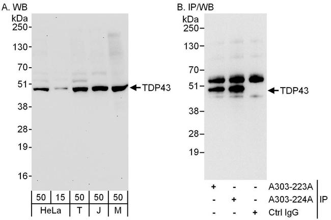 TDP43 Antibody in Western Blot (WB)