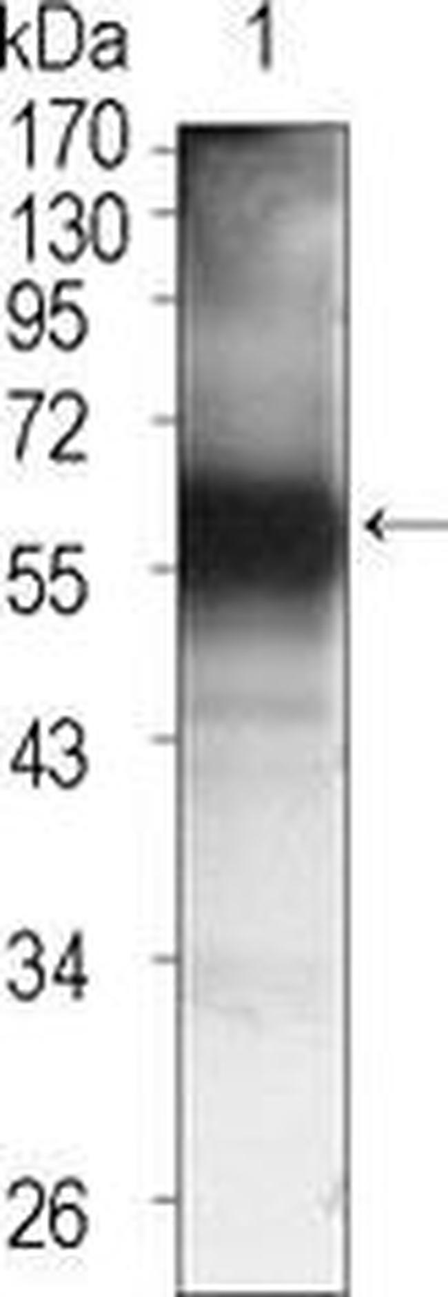 TEC Antibody in Western Blot (WB)
