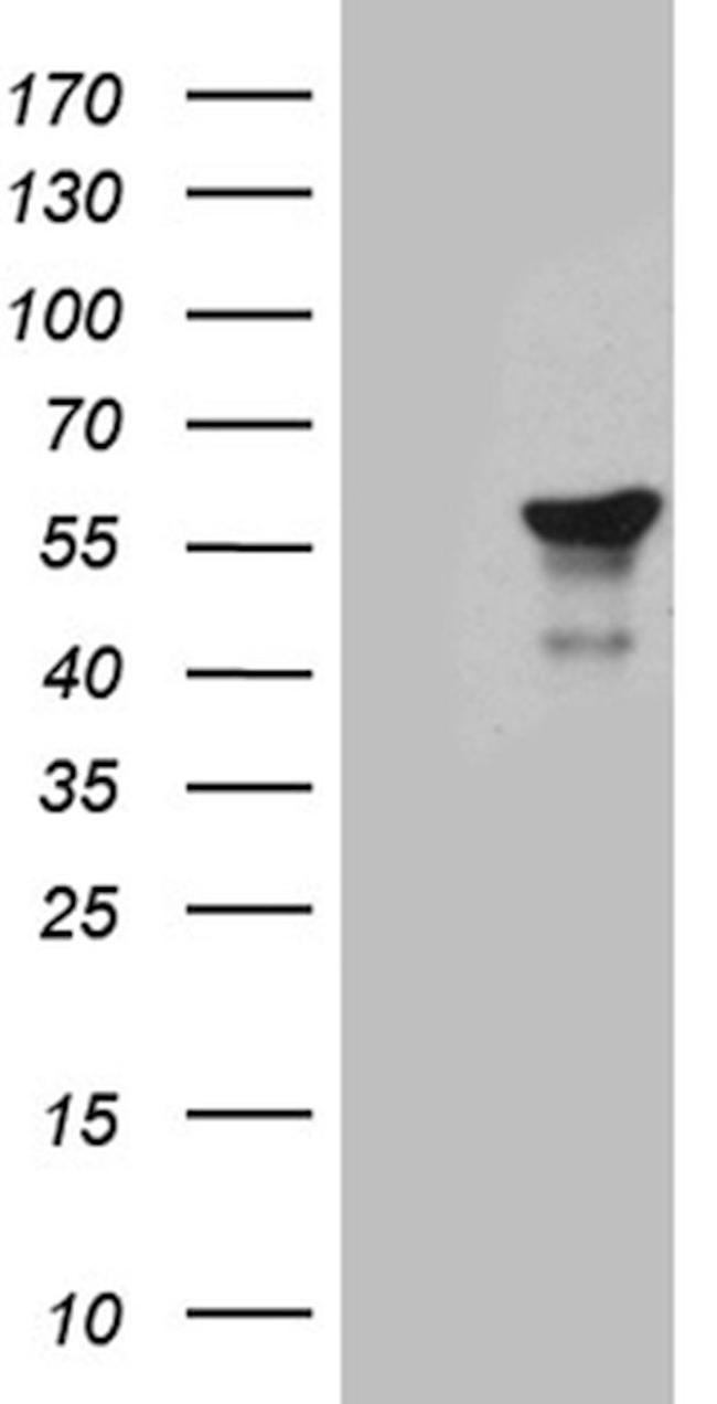 TFDP2 Antibody in Western Blot (WB)