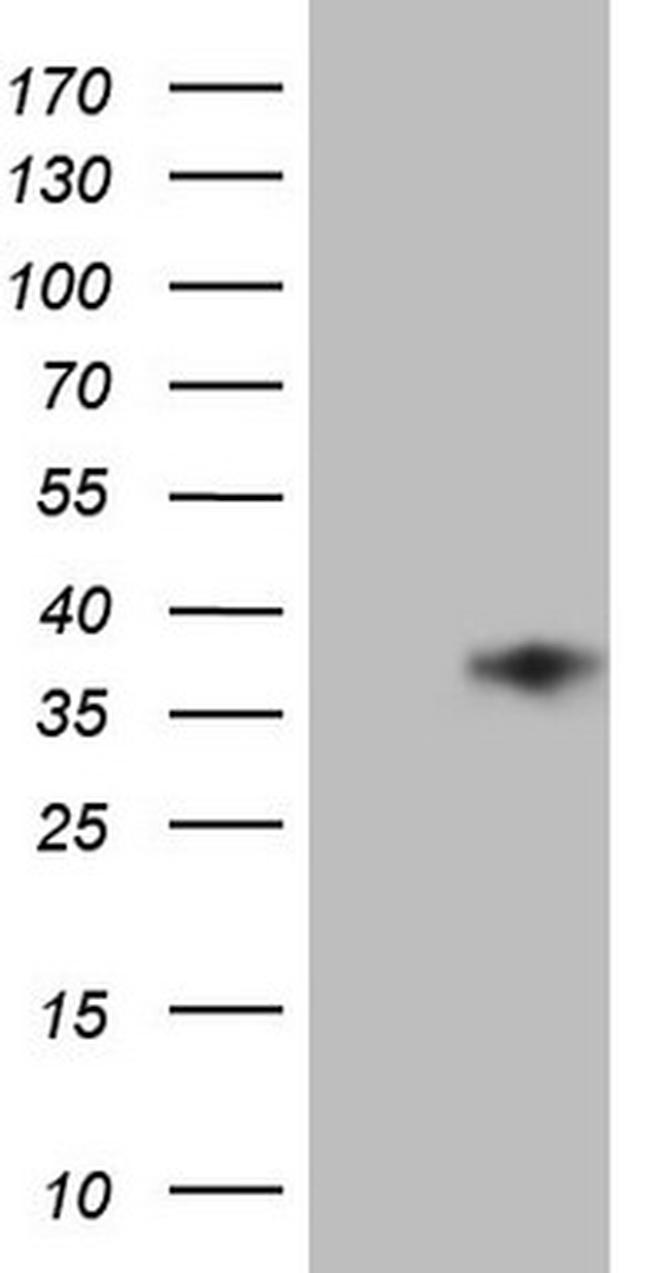 TFPI2 Antibody in Western Blot (WB)