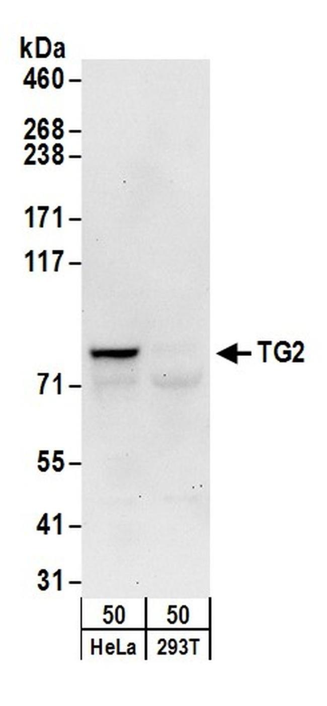 TG2 Antibody in Western Blot (WB)