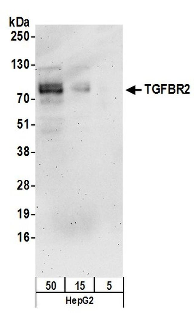 TGFBR2 Antibody in Western Blot (WB)